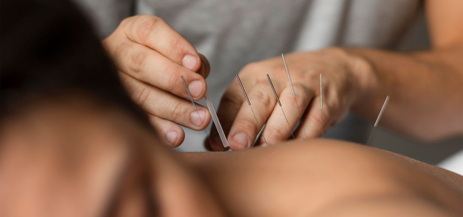 Práticas Integrativas e Complementares