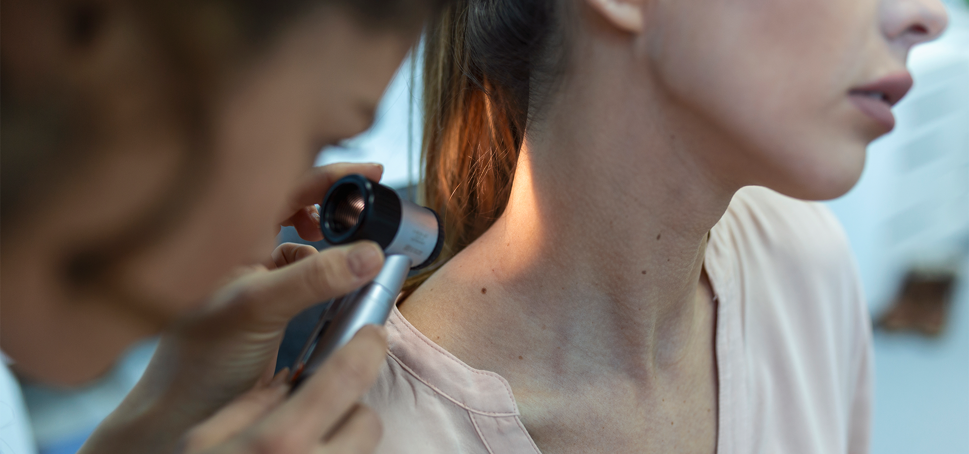 Estética Avançada: Tratamento de Discromias Cutâneas