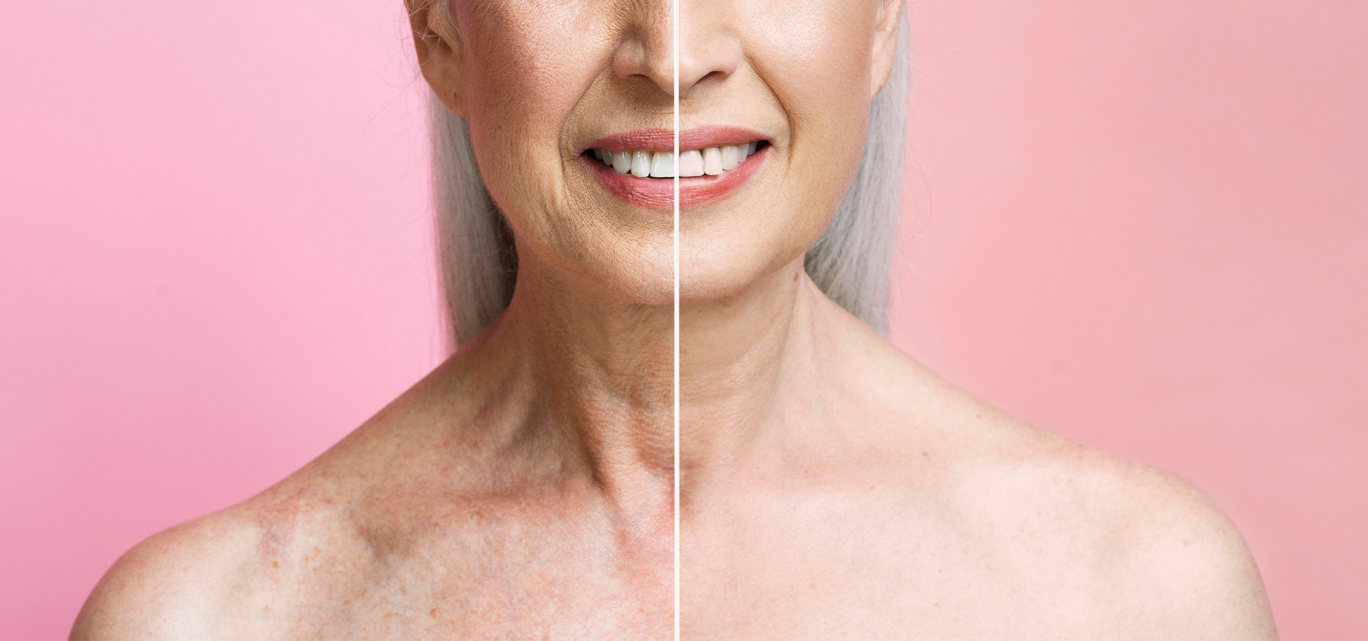 Dermatologia Estética: Manejo do Envelhecimento Cutâneo