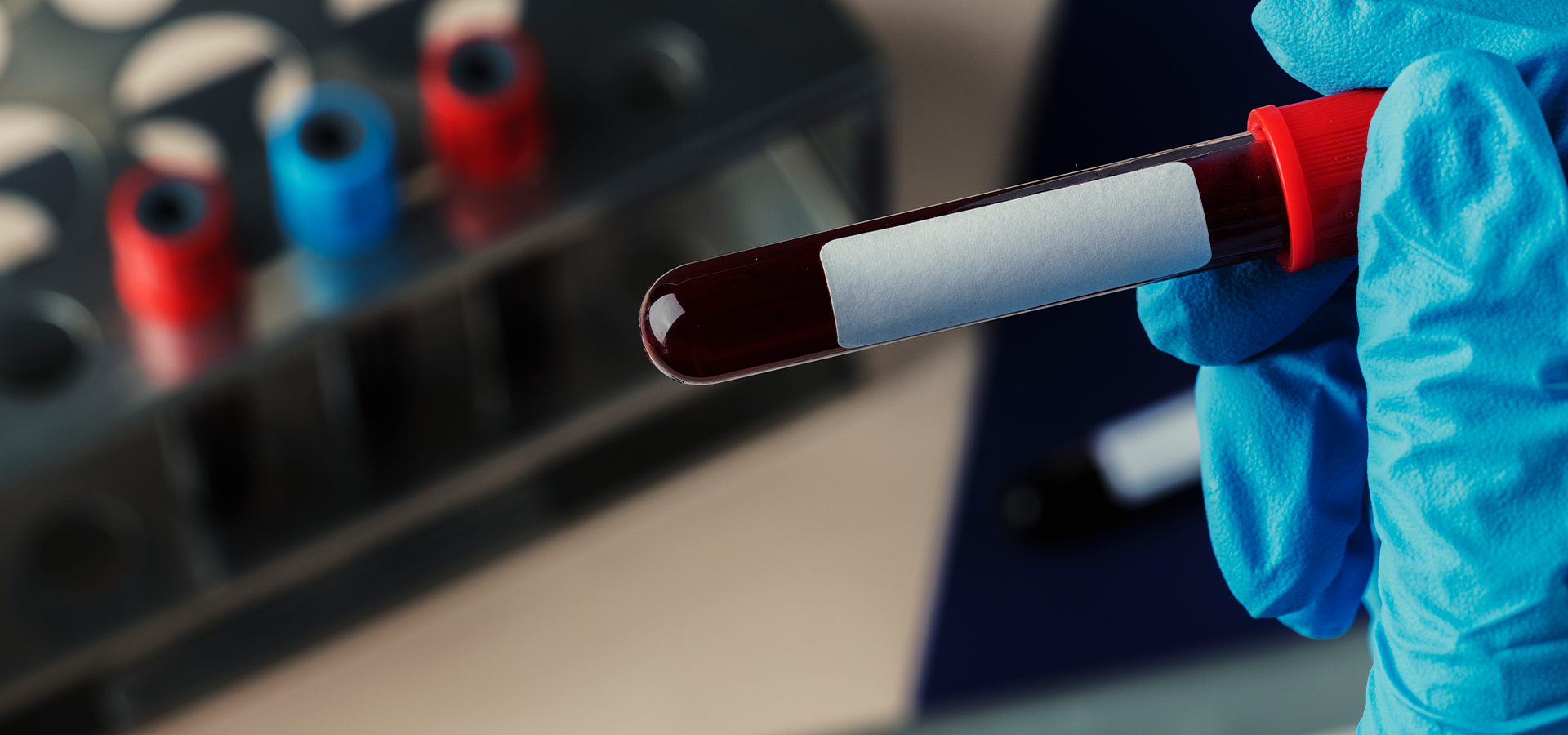 Hemograma e Coagulograma na Prática Clínica