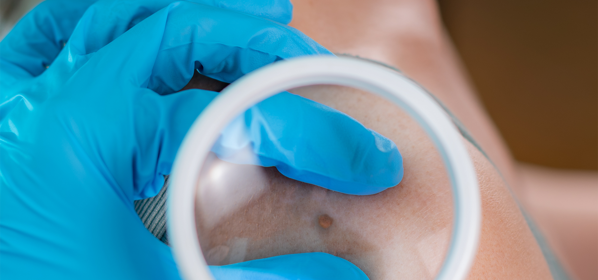 Enfermagem Dermatológica