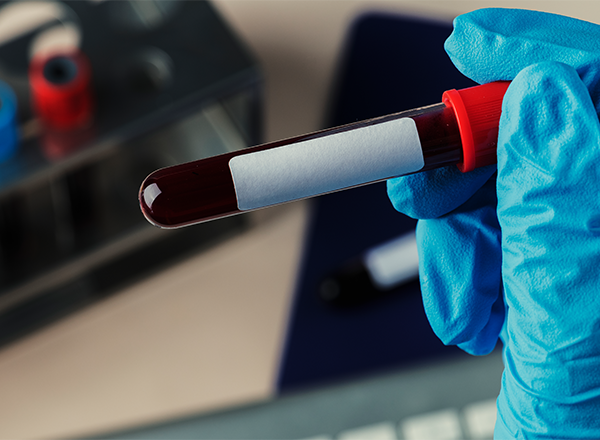 Hemograma e Coagulograma na Prática Clínica