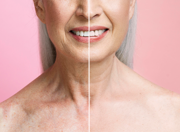 Dermatologia Estética: Manejo do Envelhecimento Cutâneo